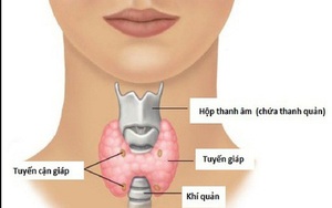 "Thực phẩm thuốc" trong điều trị bệnh cường giáp: Ăn uống đúng để giảm nhẹ bệnh tật