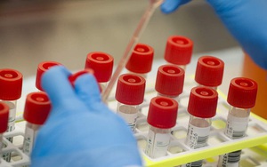 Mỹ thu hồi 12.000 bộ xét nghiệm SARS-CoV-2 do nhiễm khuẩn