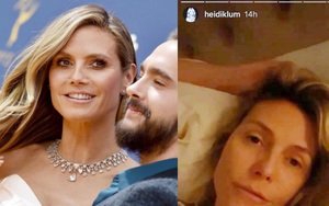 Nóng: Siêu mẫu Heidi Klum thừa nhận có triệu chứng nghi nhiễm virus COVID-19, nhưng bất ngờ không được xét nghiệm