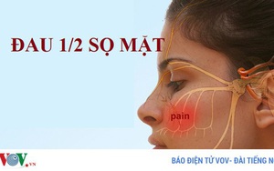 Đau nửa sọ mặt, bệnh gì?