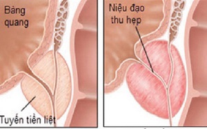 Những phương thuốc từ cỏ nhọ nồi