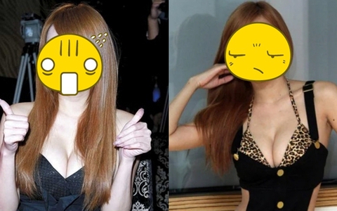 Nữ ca sĩ hành hung người đến gãy xương, xuất huyết não, soi đến gia thế càng thấy kinh hoàng