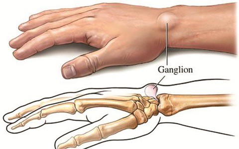 3. Triệu Chứng Nhận Biết Mắt Cá Chân Nổi Cục