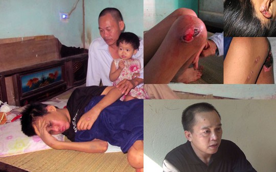 Khởi tố, bắt tạm giam gã hàng xóm hành hạ bé trai trong khách sạn