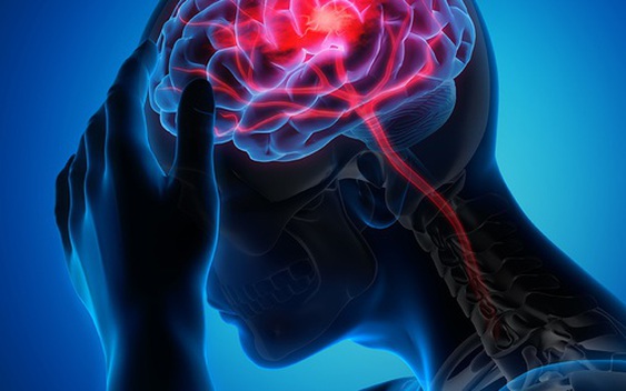 Đột quỵ gia tăng: Nghiên cứu Mỹ hé lộ thủ phạm mới