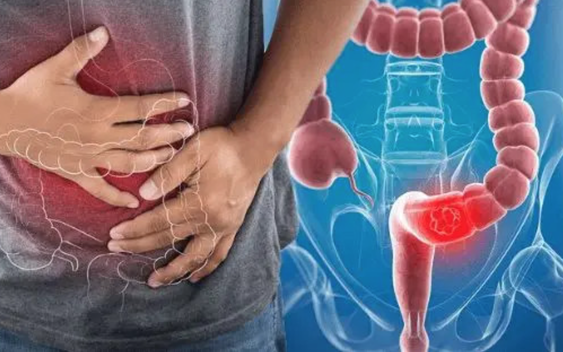 3 thói quen giúp giảm tới 90% nguy cơ mắc ung thư: Đơn giản đến mức ai cũng làm được