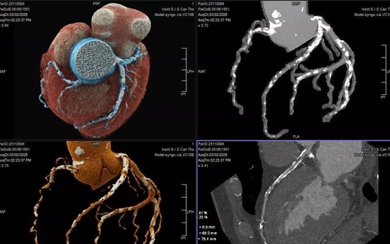 Bệnh nhân thoát nguy cơ ‘thượng mã phong’ nhờ chia sẻ chuyện phòng the