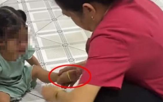 Vụ "cô giáo mầm non" liên tục bắn dây chun vào chân bé gái: Khi niềm tin của người mẹ bị gặm nhấm bởi những con sâu mọt