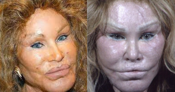 Jocelyn Wildenstein, famosa por 'recorde de plásticas', é presa acusada de apunh