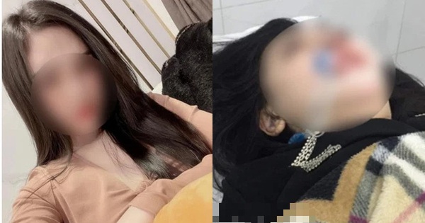The beautiful 22-year-old girl died after more than 2 months in a deep coma due to rhinoplasty surgery