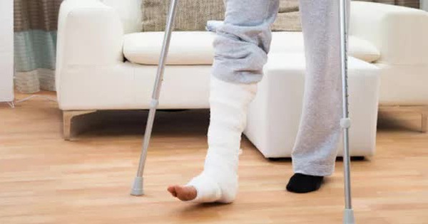 A young man was beaten with jealousy and broke his leg while talking to other people’s wives