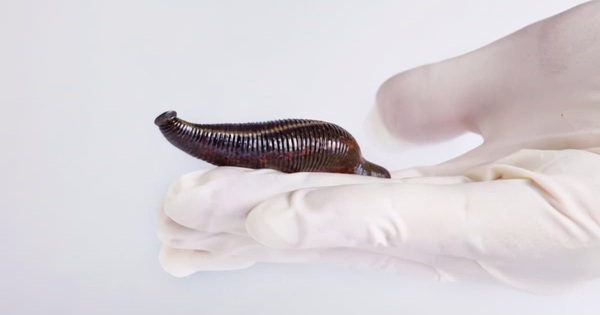 The truth about “leeches must be lime”: Leeches are in food, but they live and harm people