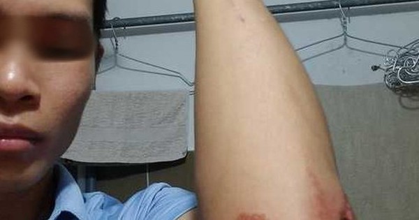 Technology car driver was brutally attacked near Mien Tay Bus Station