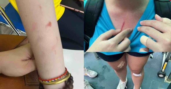 The case that the parents of the International School of Ho Chi Minh City “accused” their child was beaten by a classmate, the school suffered a “super storm” with a 1-star rating