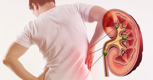 Signs that your kidneys are ‘calling for help’, go to the doctor right away before it’s too late
