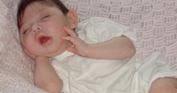 Cô bé sinh ra không có não bây giờ ra sao?