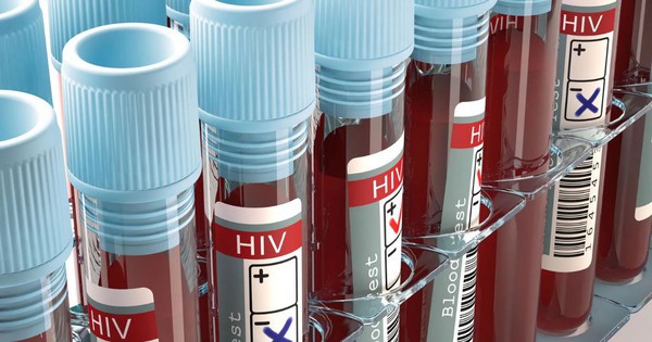 Người phụ nữ nhiễm HIV dù chồng và con gái không hề mắc bệnh: Phân tích virus cho kết quả gây sốc