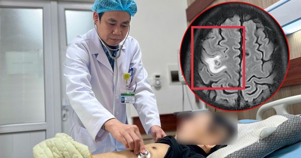 Người đàn ông Hà Nội tổn thương não diện rộng do nguyên nhân bất ngờ - không phải khối u