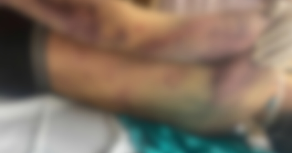 Vừa lên học được 2 ngày, học viên của Trung tâm công tác xã hội Hải Hà tử vong: Công an vào cuộc