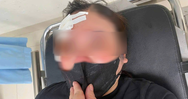 Người phụ nữ đi xe máy "tố" bị tài xế xe bán tải dùng dùi cui vụt vào đầu