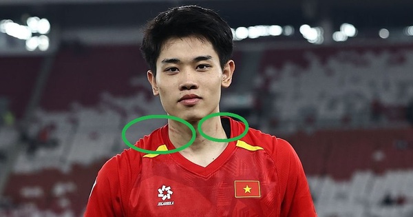 Chân sút số một U23 Việt Nam bị cầu thủ Indonesia bóp cổ, lên nhận giải thưởng vẫn còn rõ vết thương