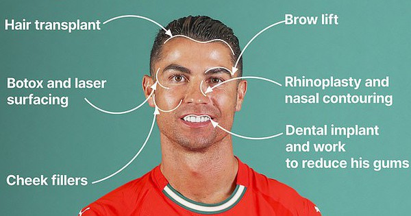 Ronaldo 40 tuổi vẫn đẹp trai cực phẩm, bác sĩ thẩm mỹ khui loạt bí mật “dao kéo” tốn kém bạc tỷ
