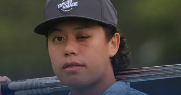 Jeffrey Guan và hành trình trở lại sân golf phi thường sau bi kịch mất một mắt