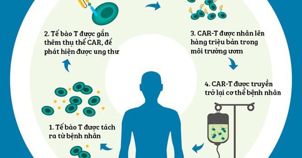 Liệu pháp CAR-T được dùng điều trị ung thư máu là gì?