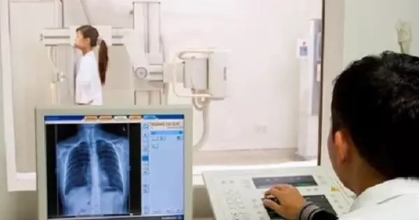 Bộ Y tế chấn chỉnh việc từ chối thanh toán bảo hiểm y liên quan chụp X Quang