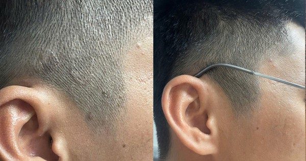 Xu hướng chăm sóc da đầu mới: Không chỉ sạch gàu mà còn phải “sạch bền vững”