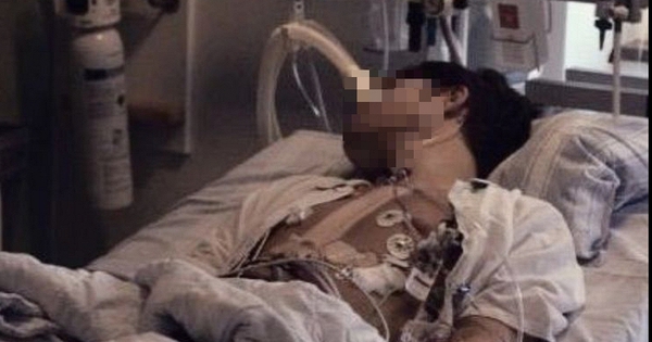 Nam sinh 18 tuổi tử vong vì ung thư đại trực tràng, bác sĩ: Nguyên nhân là món thịt thơm lừng, trẻ em Việt rất thích