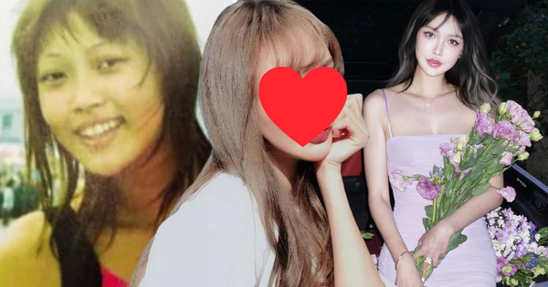 Cô gái cao 1m80 bị ép dao kéo từ năm 14 tuổi, hơn 300 lần phẫu thuật: Gương mặt hiện tại thế nào?