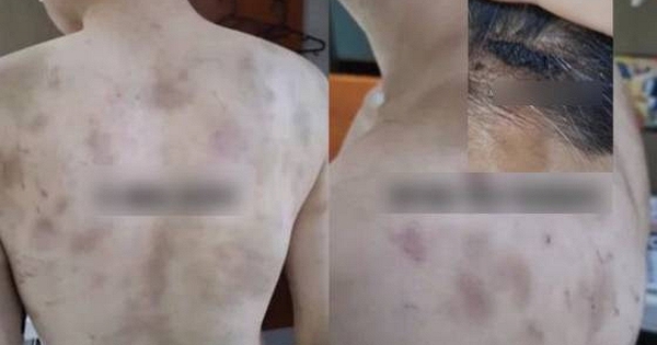 Rúng động Hàn Quốc: Nam nhân viên bị chủ quán hành hạ, ép làm việc 20 giờ/ngày, camera giám sát 24/7