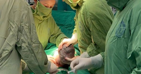 Em bé sinh ra với 