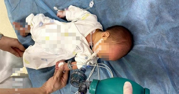 Em bé 52 ngày tuổi ngộ độc Botulinum nguy kịch vì loại nước chữa ho, bổ phổi rất quen từ bà ngoại