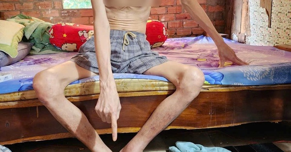 Bắt giữ Hoàng Thanh Hùng, thu giữ 36 ống hút nhựa