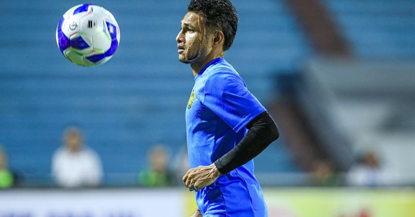 Xót xa gương mặt đầy sẹo của ngôi sao tuyển Malaysia bị tạt axit