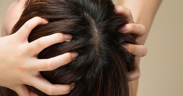 Bác sĩ cảnh báo 5 thành phần “độc hại” trong dầu gội cần tránh