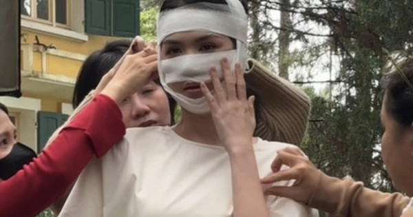 Hình ảnh Ngọc Trinh băng bó kín cả mặt