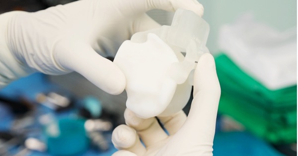 Lần đầu tại Việt Nam: Thay khớp gối bằng robot AI 