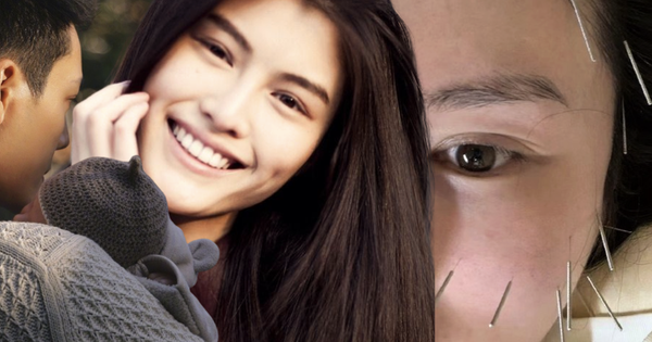 Vợ tổng tài hot nhất Trung Quốc ghim hàng chục cây kim lên mặt để ngăn xệ sau sinh