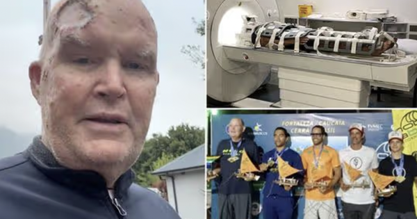 Nhà vô địch Olympic với lỗ thủng trên đầu, mất nửa tai, bị bác sĩ 