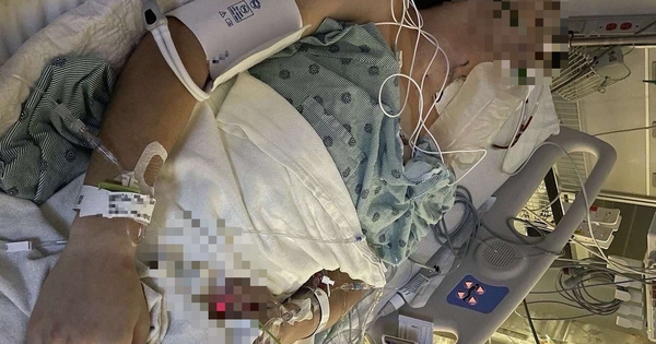 Chàng trai 26 tuổi phải cắt bỏ hơn 10cm 