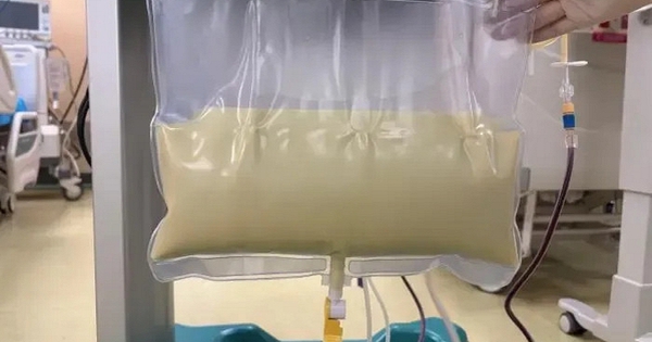 Sản phụ mang song thai gặp tình trạng “máu như sữa” nguy kịch