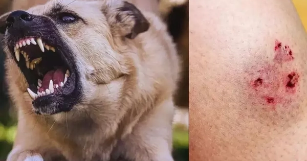 Chó 'điên' cắn 4 người ở Quảng Ngãi dương tính vi rút dại