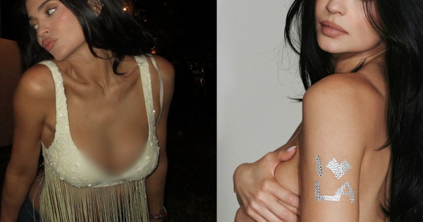 Tình hình của Kylie Jenner sau nghi vấn vỡ túi ngực ở Coachella