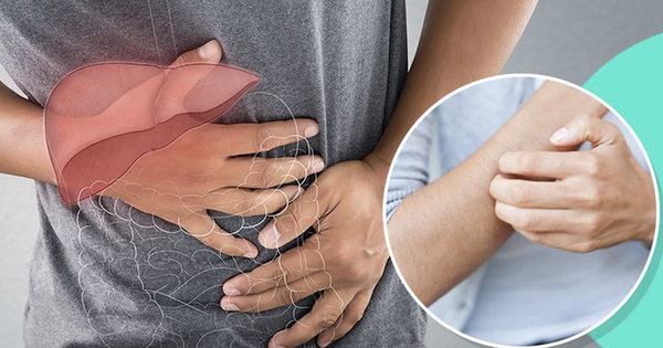 Không phải dị ứng: 2 DẤU HIỆU cơ thể đang “kêu cứu” vì ung thư gan, nhiều người Việt vẫn chủ quan