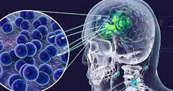 Cà Mau cập nhật thông tin vụ 2 ca não mô cầu