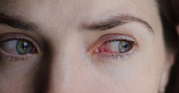 Chàng trai 24 tuổi mù đột ngột: Bác sĩ cảnh báo về thói quen mà nhiều người trẻ đang mắc mỗi tuần