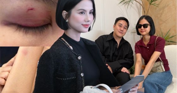 Động thái mới của nữ bác sĩ sau khi Trung Quân idol gặp mặt xin lỗi